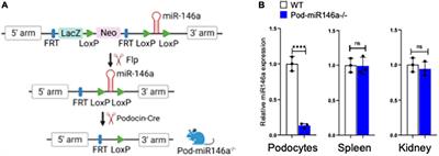 Podocyte-specific deletion of miR-146a increases podocyte injury and diabetic kidney disease